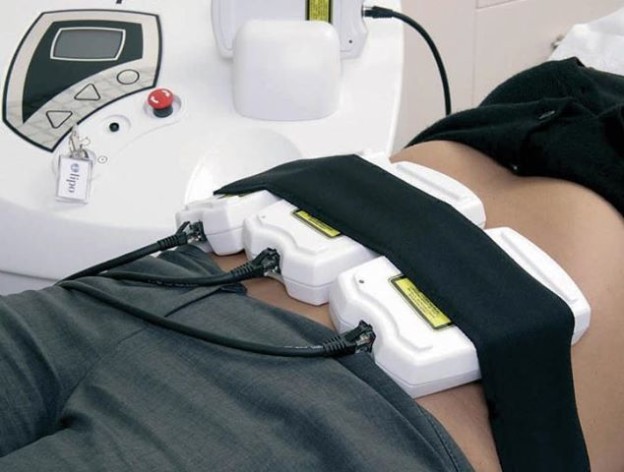 i-lipo-tampa-01 - Doctory