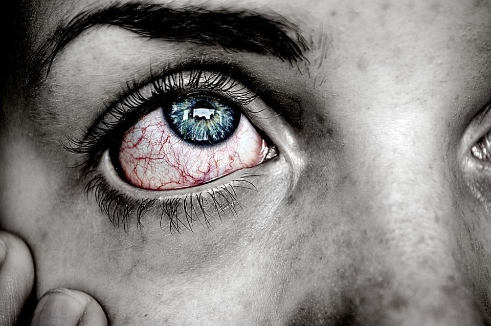 Red Eye Causes and How to Treat Red Eyes