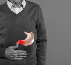 Gastroesophageal Reflux Disease: Causes, Signs, Treatment
